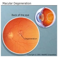 basics_macular-degeneratie