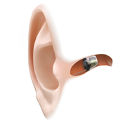 Virto B-titanium onzichtbaar hoorapparaat in het oor Lyric