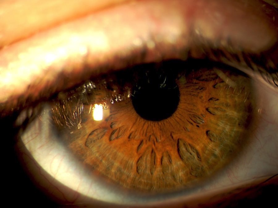 oogonderzoek oogarts zichtmeting oogtest leesbril contactlenzen Lokeren